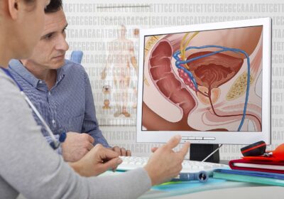 Microplastic în tumori canceroase: ce nu spun studiile oficiale
