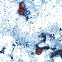 Cyclospora în 45 de state americane: ce ascunde CDC-ul?